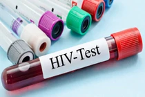 Virus giống HIV, nguy cơ lây sang người nguy hiểm sao?