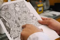 Loại virus gây dịch mới, triệu chứng có thể giống đột quỵ