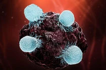 Nghiên cứu đột phá về hiệu quả của loại vắc xin trị ung thư