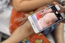 Bệnh tay chân miệng ở TP.HCM tăng báo động