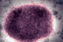 Bùng phát virus hiếm gặp và bất thường tại Anh