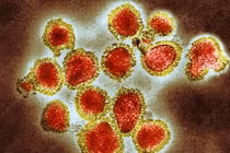 Làn sóng dịch cúm bao trùm khắp Ấn Độ