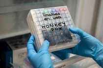 WHO họp khẩn, cân nhắc đậu mùa khỉ là tình trạng khẩn cấp toàn cầu