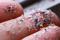 Lần đầu phát hiện hạt vi nhựa trong máu người