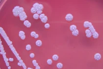 Biết gì về bệnh Whitmore nguy hiểm?