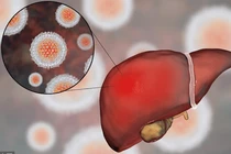 5 loại thực phẩm là thần hộ mệnh của gan, nên ăn thường xuyên