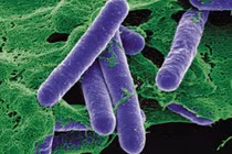 Sự nguy hiểm của loại vi khuẩn gây ngộ độc Botulinum