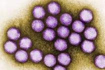 6 trẻ tử vong do virus Adeno: Biến chứng nguy hiểm sao?