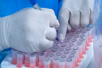 Nguy cơ xâm nhập biến chủng Omicron vào Việt Nam là rất lớn