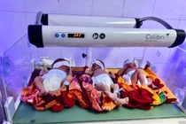 Sản phụ ở Nghệ An sinh ba cùng trứng hiếm gặp