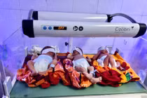 Sản phụ ở Nghệ An sinh ba cùng trứng hiếm gặp