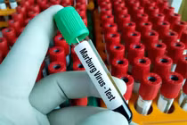 Đường lây của virus khiến 9 người chết sau khi đi dự đám tang