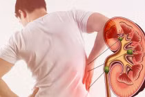 4 thói quen khiến thận lổn nhổn toàn sỏi