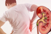 4 thói quen khiến thận lổn nhổn toàn sỏi
