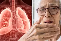 Triệu chứng nhiễm trùng phổi ít người để ý