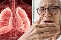 Triệu chứng nhiễm trùng phổi ít người để ý