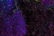 Loại virus cổ có thể là chìa khóa để điều trị ung thư phổi