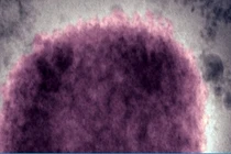 WHO họp khẩn về nguy cơ bùng phát dịch bệnh mới