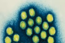 Phát hiện mới về nguyên nhân gây viêm gan bí ẩn