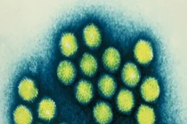 Phát hiện mới về nguyên nhân gây viêm gan bí ẩn