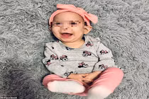 Bé gái 10 tháng tuổi bị chó nhà tấn công tử vong