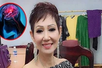 6 biểu hiện cảnh báo đột quỵ sớm ở nữ giới không được bỏ qua