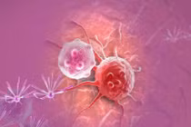 6 thói quen ăn uống có thể đang “nuôi” tế bào ung thư