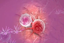 6 thói quen ăn uống có thể đang “nuôi” tế bào ung thư