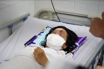 Mù mắt sau khi nâng mũi ở spa