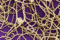 Suy gan thận sau khi tắm thác...xoắn khuẩn gây bệnh nguy hiểm thế nào?