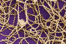 Suy gan thận sau khi tắm thác...xoắn khuẩn gây bệnh nguy hiểm thế nào?