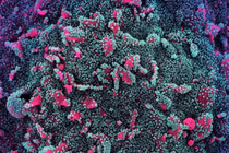 Biến chủng BA.5 Omicron vừa xâm nhập vào Việt Nam nguy hiểm thế nào?