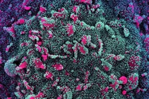 Biến chủng BA.5 Omicron vừa xâm nhập vào Việt Nam nguy hiểm thế nào?