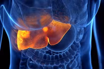 Uống loại nước này mỗi ngày làm tăng nguy cơ mắc ung thư gan