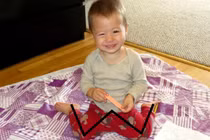 Tư thế ngồi sai lầm của trẻ dễ dẫn đến chân vòng kiềng