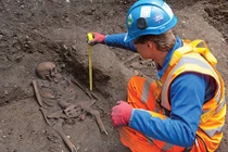 Những căn bệnh lạ chưa tìm ra câu trả lời thỏa đáng