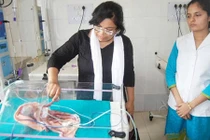 Mẹ sốc khi thấy con sinh ra 2 mình, 4 chân, 4 tay