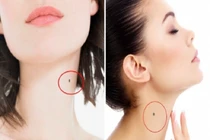 Nốt ruồi đúng vị trí tài lộc, phụ nữ có số sướng cả đời