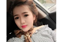 Cô gái sứt môi hở hàm ếch lột xác thành hotgirl