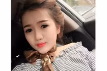 Cô gái sứt môi hở hàm ếch lột xác thành hotgirl