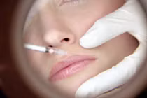 Biến chứng nguy hiểm khi phẫu thuật tạo hình môi