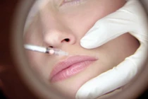 Biến chứng nguy hiểm khi phẫu thuật tạo hình môi