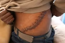 Bắt giữ nhiều bác sĩ tham gia đường dây buôn bán nội tạng