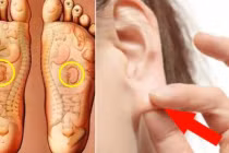 8 cách chăm sóc thận đơn giản mà ai cũng làm được