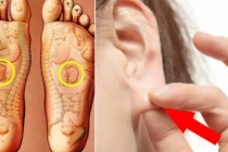 8 cách chăm sóc thận đơn giản mà ai cũng làm được