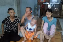 Lời dặn của cha với con gái thiểu năng nhiễm HIV