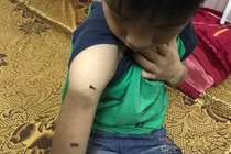 Video: Bé 9 tuổi nghi bị bố bạo hành chỉ rõ từng vết thương trên cơ thể