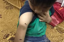 Video: Bé 9 tuổi nghi bị bố bạo hành chỉ rõ từng vết thương trên cơ thể