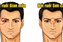 4 vị trí nốt ruồi trên mặt gây “tán lộc” cần hóa giải ngay