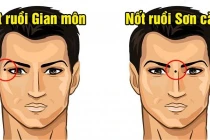 4 vị trí nốt ruồi trên mặt gây “tán lộc” cần hóa giải ngay